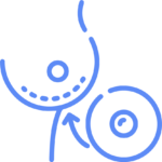 Explantación o cambio de implantes