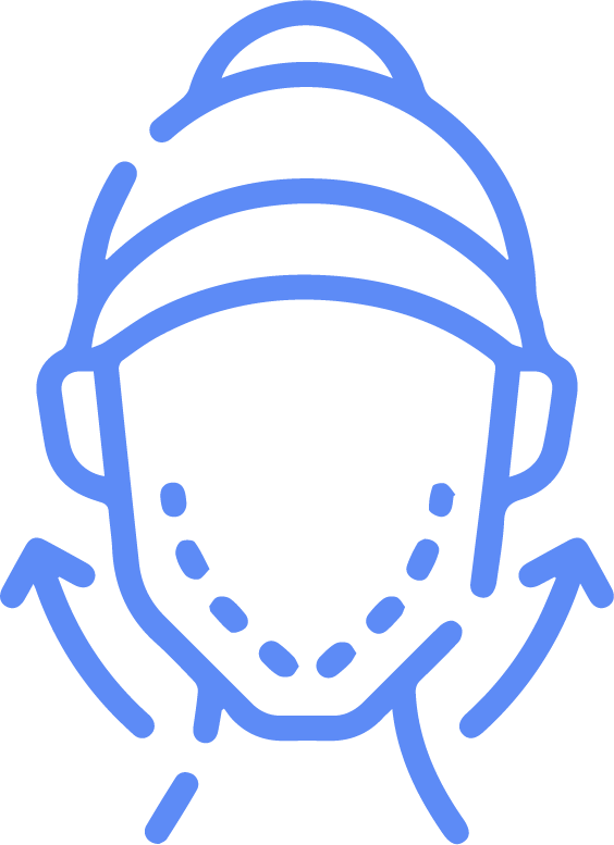 Bichectomía (Reducción de cachetes)